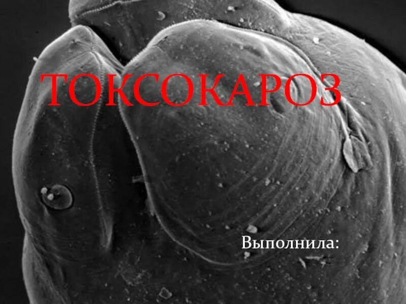 Луна паразит