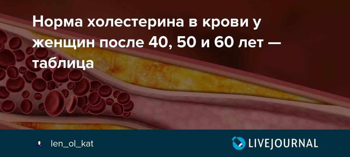 Кровь у мужчин после 50. Норма холестерина у женщин 60 лет в крови. Норма холестерина в крови у женщин после 50. Холестерин норма у женщин после 50. Норма холестерина в крови у женщин после 50 лет.