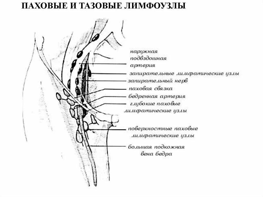 Лимфатическая система малого таза. Тазовые лимфатические узлы. Паховые лимфатические узлы схема. Лимфатическая система малого таза мужчин. Лимфатические узлы малого таза анатомия.