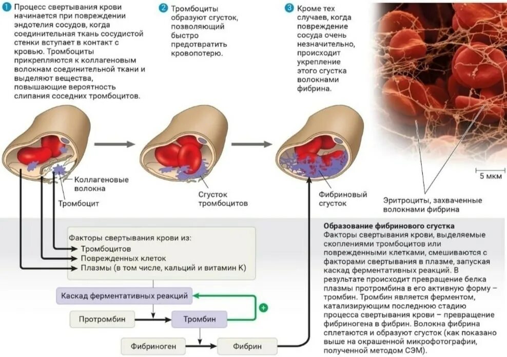 Изменение свертывания крови. Схема свертывания крови образование сгустка. Механизм процесса свертывания крови. Механизм свертывания крови схема. Свертывание крови схема ЕГЭ.