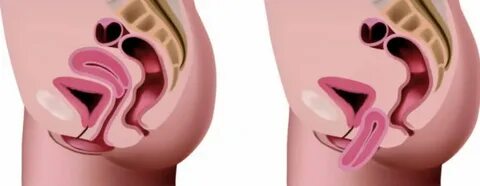 Жалаңаш әйел күйеуін доппен теуіп жатыр