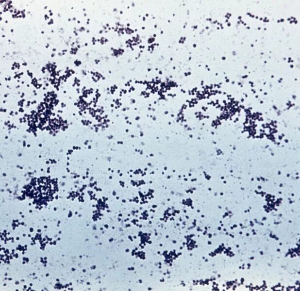 Стафилококки окраска. Стафилококк метиленовый синий. staphylococcus aureus чистая культура. чистая культура стафилококка. стафилококк окраска метиленовым.