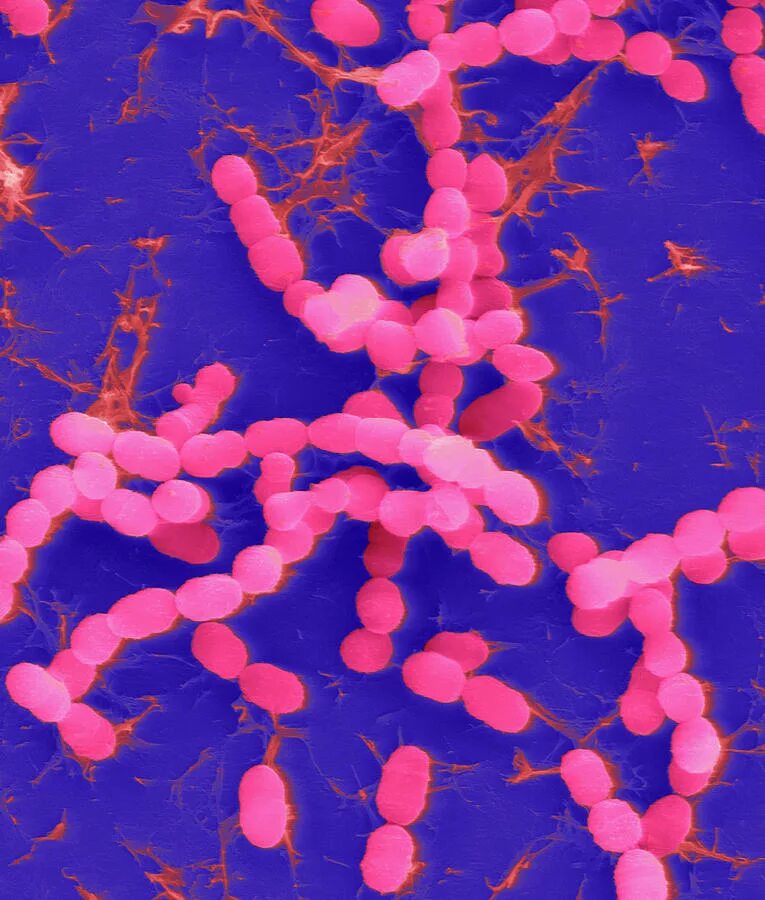 Streptococcus thermophilus. Термофилус стрептококк. salivarius стрептококк. стрептококки streptococcus thermophilus. термофильный стрептококк микроскопия.