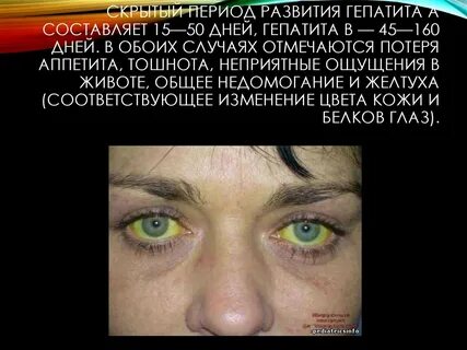 Гепатит глаза какие