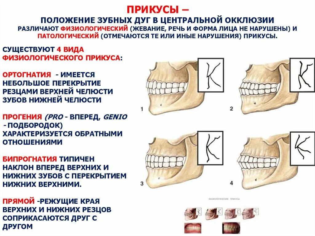 Почему зубы отличаются между собой. Правильный прикус у человека схема сбоку. Физиологические и патологические виды прикуса. Правильный прикус вид сбоку у ребенка. Ортогнатический прикус сбоку.