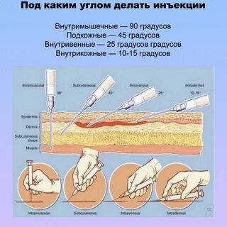 Куда делаются инъекции