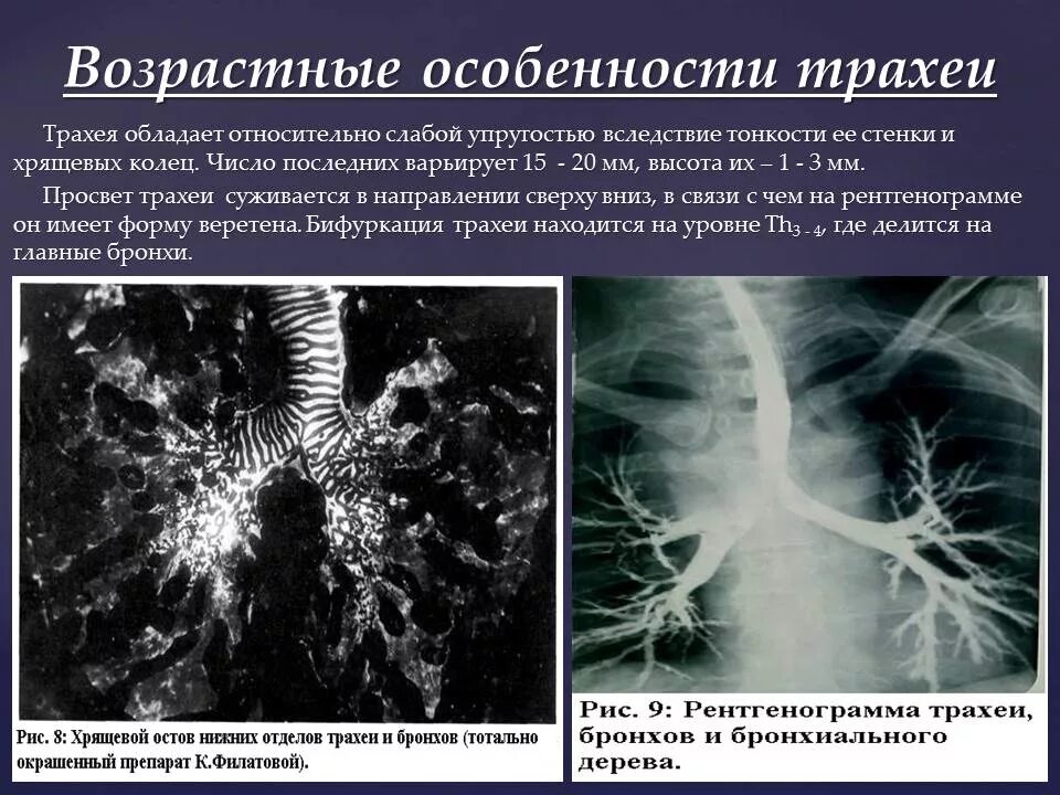 Возрастные изменения в легких. Возрастные особенности бронхов. Возрастные особенности трахеи. Возрастные особенности трахеи и бронхов. Возрастные изменения трахеи и бронхов.