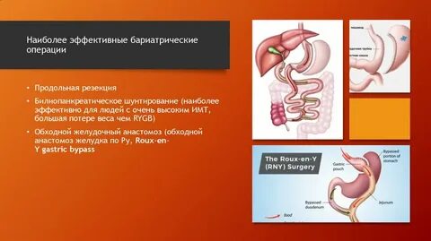 Меню после бариатрической операции
