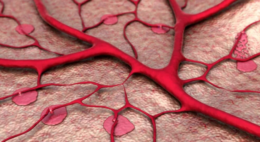 Омоложение сосудов