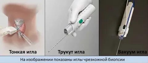 Сколько по времени делается пункция