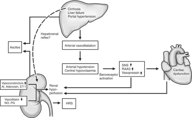 Гипертонии печень. Сердечная недостаточность и портальная гипертензия. Портальная гипертензия схема. Предпеченочная портальная гипертензия. Виды печеночной гипертензии.