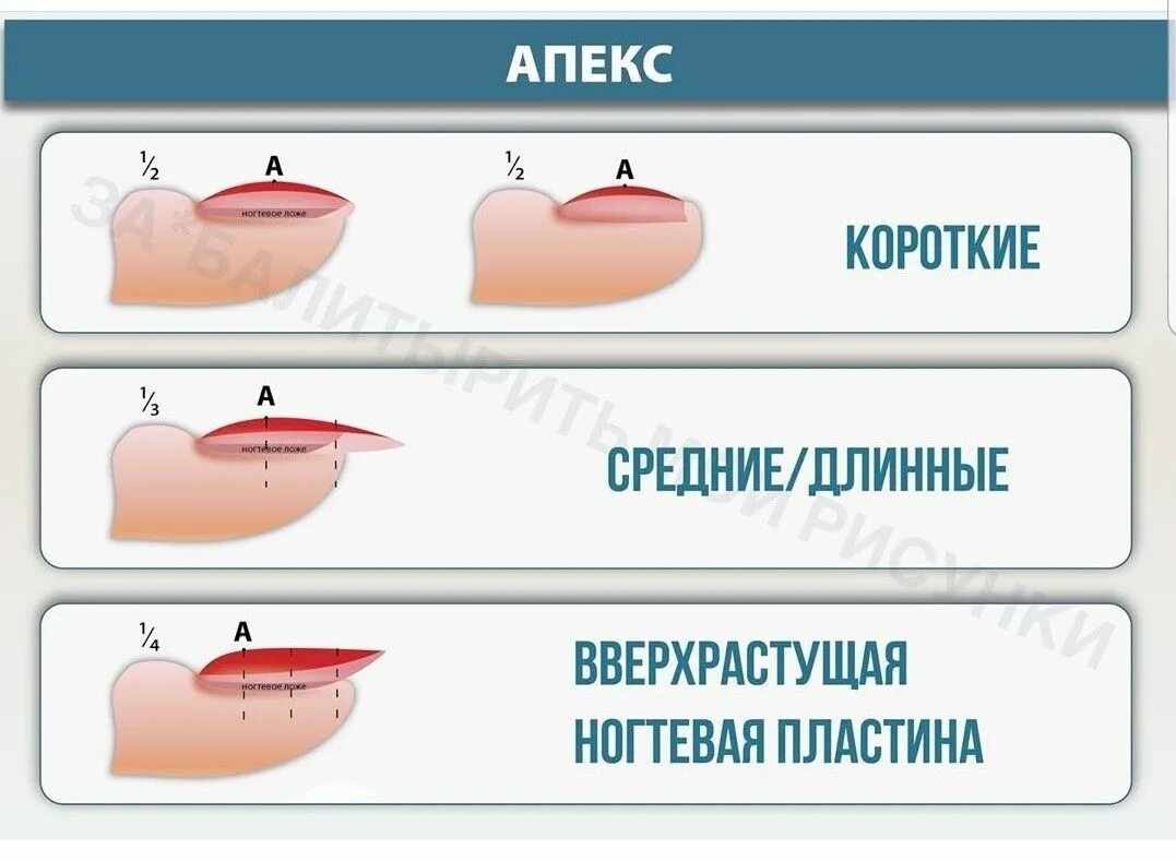 Как получить нового апекса