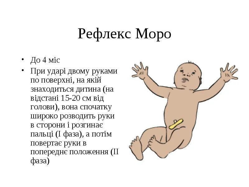 Рефлекс Моро у новорожденных. Рефлекс Монро новорожденных. Спонтанный рефлекс Моро у новорожденных что это. Эффект мора у грудничков.