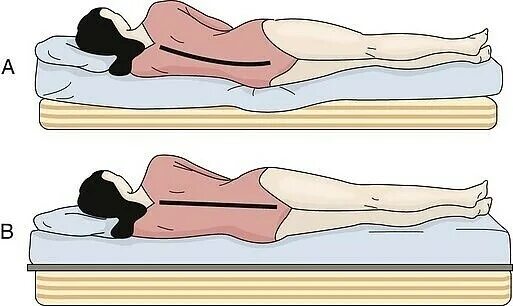 Сон на боку позвоночник. Как правильно лежать на кровати. Поза для сна для позвоночника. Правильные позы для сна при остеохондрозе. Поза сна на спине.