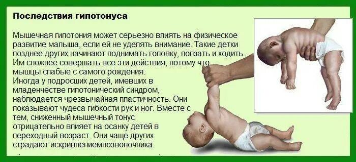 Откат в развитии ребенка. Гипотонус массаж грудничку. Тонус мышц у новорожденных 2 месяца. Массаж при гипотонусе у младенцев 2 месяца. Слабый тонус мышц рук у новорожденного ребенка.