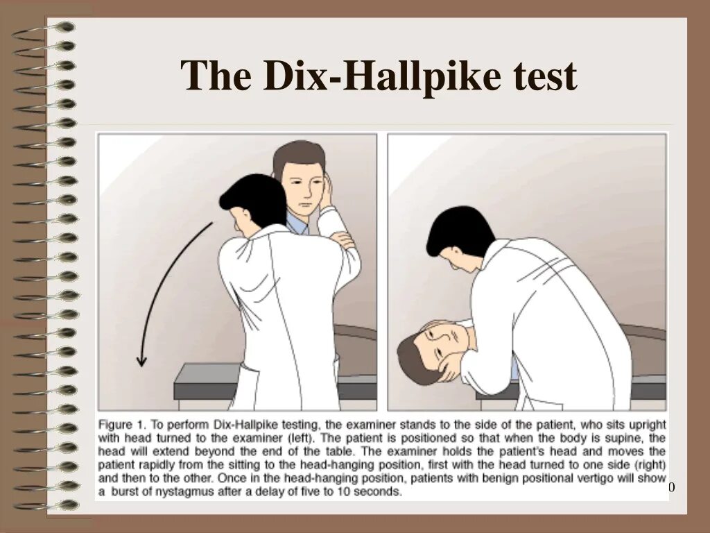 Проба холпайка. Dix Hallpike. Dix-Hallpike Test. Проба Дикса-Холлпайка. BPPV тестирование.