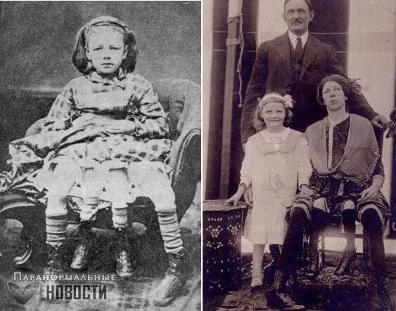 Жозефина корбин четырехногая. Жозефина миртл корбин (1868-1928). Жозефина корбин четырехногая. Жозефин миртл корбин четырехногая женщина. Девочка с 4 ногами.