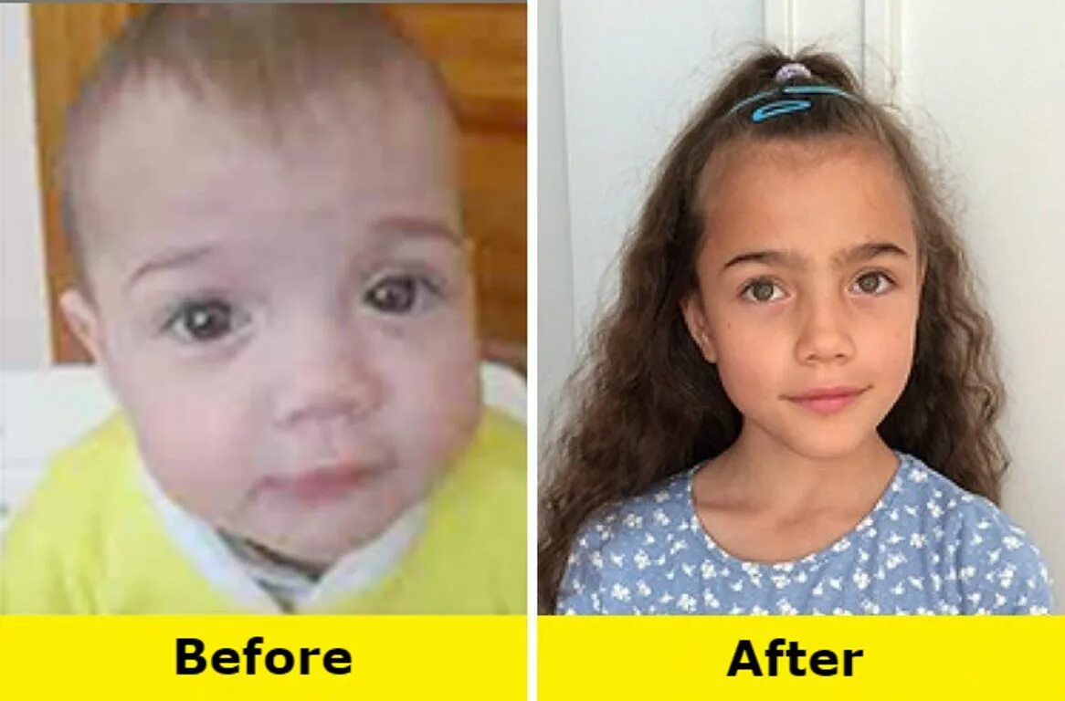Ребенок до и после. Дети до и после усыновления. Детки до и после усыновления. Дети из детдома до и после усыновления.