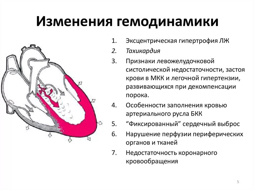 Митральная недостаточность гемодинамика схема. Недостаточность клапана аорты гемодинамика порока. Недостаточность клапанов аорты гемодинамика схема. Аортальная недостаточность гемодинамика схема.