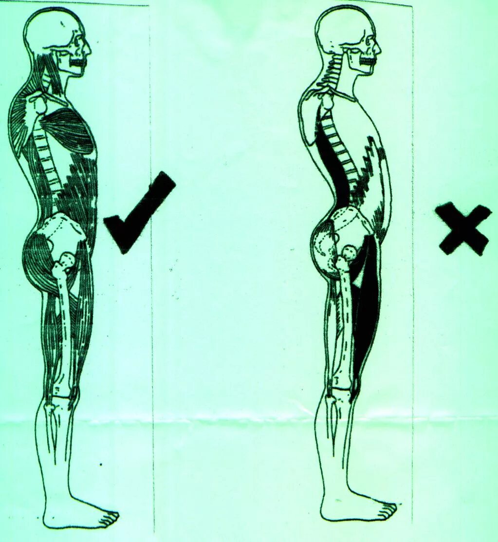 Правильная поясница. Осанка. Правильная осанка. Правильная осанка позвоночника. Нарушенная осанка.
