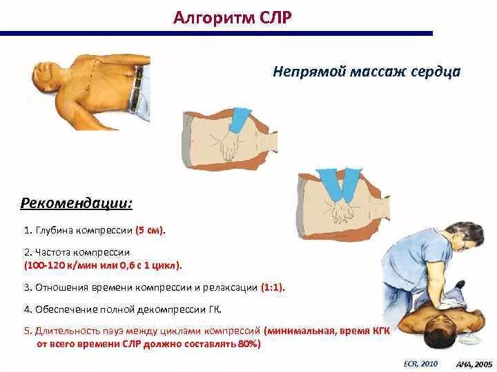 Алгоритм массажа сердца. Алгоритм сердечно-легочной реанимации 1 непрямой массаж сердца. алгоритм проведения реанимации непрямого массажа сердца. частота компрессий при сердечно-легочной реанимации. сердечно легочная реанимация не прямой массад алгоритм.