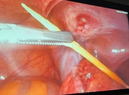 Türkiye'de sadece 3 kişide bu vaka görülmüş... 