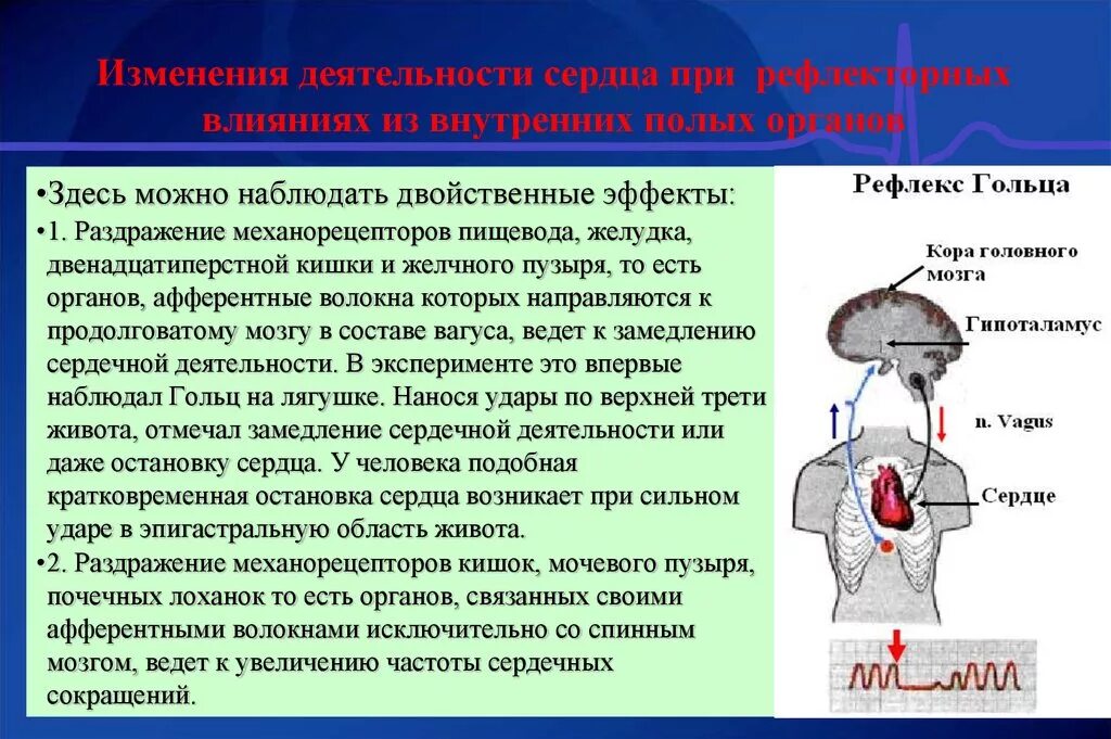 : Рефлексы сердца (опыт гольца). Рефлекторное раздражение вагуса. Рефлекс гольца физиология. Механизм возникновения рефлекса гольца.