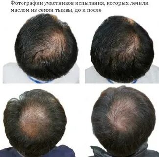 От семечек болит
