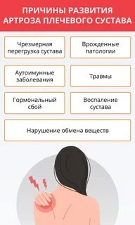 Препараты для лечения артроза плечевого сустава