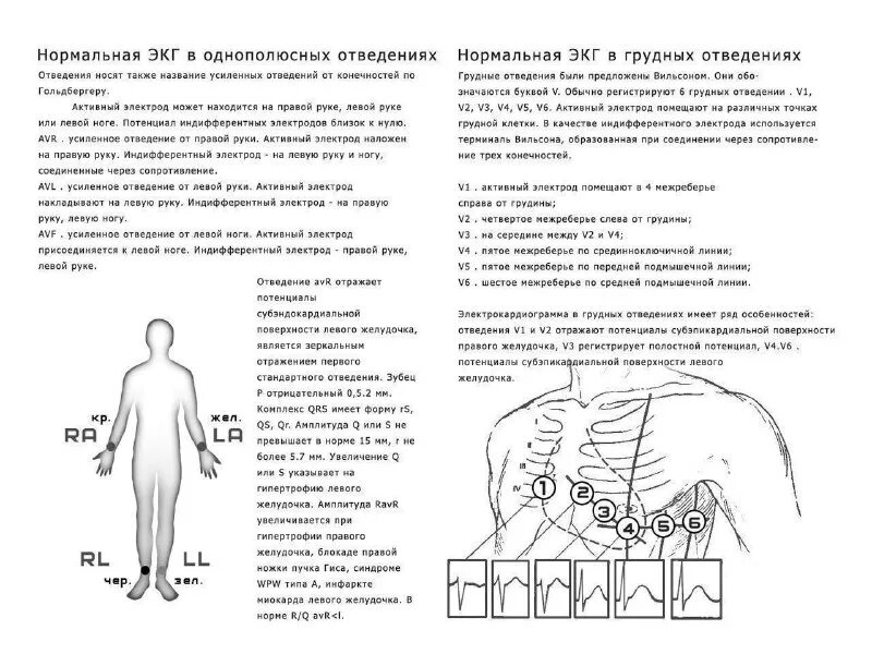 Экг методика наложения электродов. Электрокардиография наложение электродов. Правильная постановка электродов экг. Как снимать кардиограмму. Электроды отведения экг.
