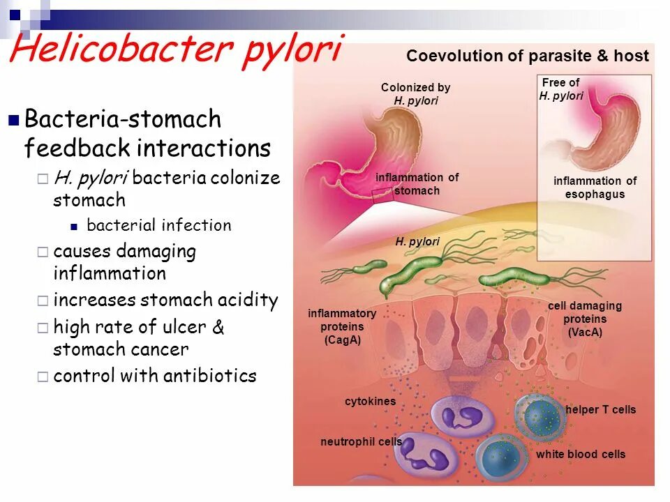 Хеликобактер пилори погибает. Уреаза хеликобактер пилори. Helicobacter pylori симптоматика. Хеликобактер пилори 2,7. Обсеменение хеликобактер пилори.