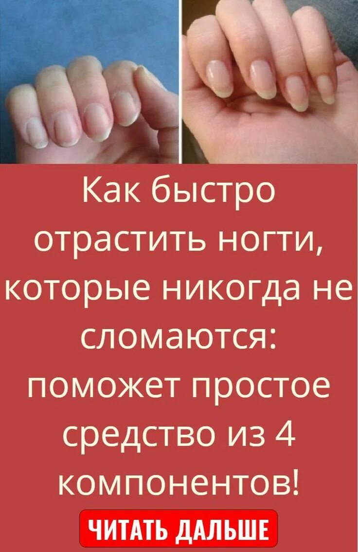 Как быстро отрастить ногти ребенку. Быстро отрастить ногти. как отрастить ногти. советы как быстро отрастить ногти. рецепт чтобы отрастить ногти.