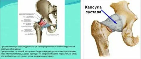 Тазобедренный сустав тип соединения