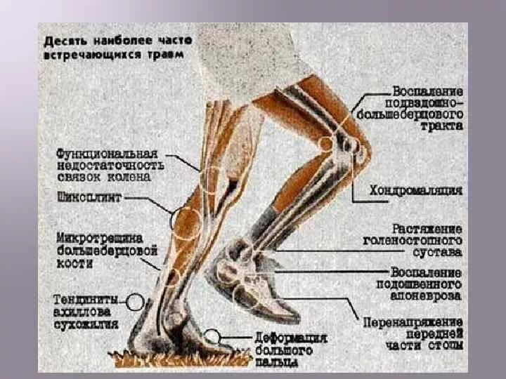 Почему не двигается нога. Перенапряжение передней части стопы. Строение ноги. Строение щиколотки ноги.