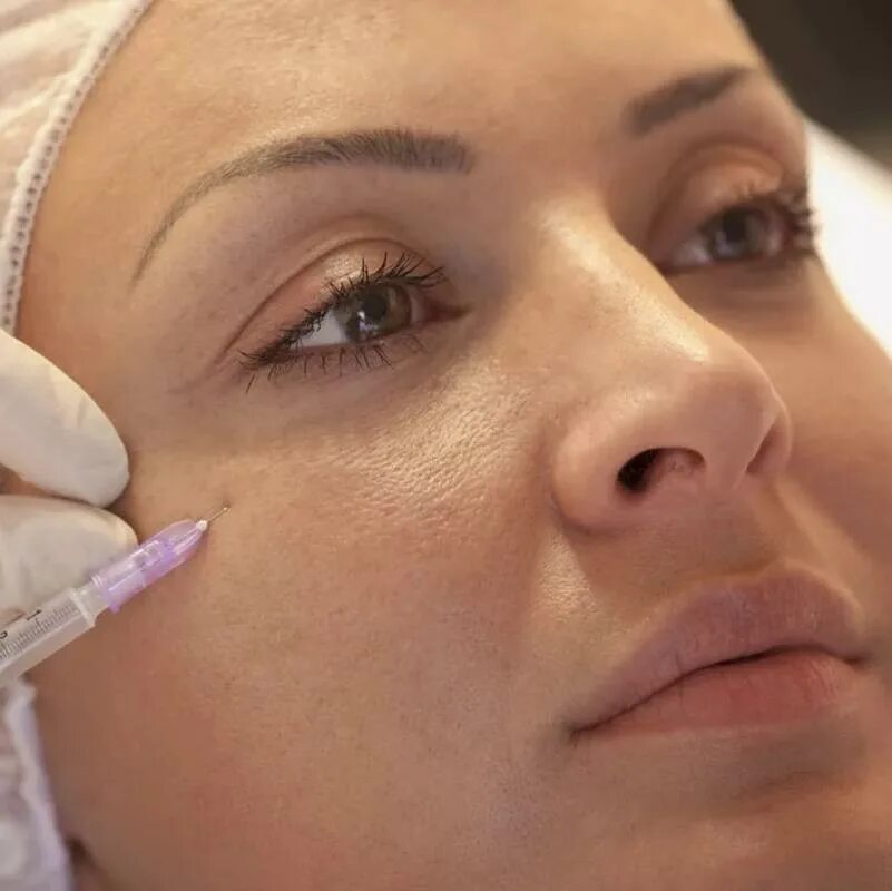 Алина Боженова - Красота, Услуги косметологов, Услуги косметологов по чистке лиц