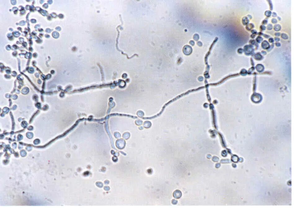 Споры candida. Кандида альбиканс микроскопия. Грибы кандида микроскопия. Кандида альбиканс под микроскопом. Хламидоспоры кандида.