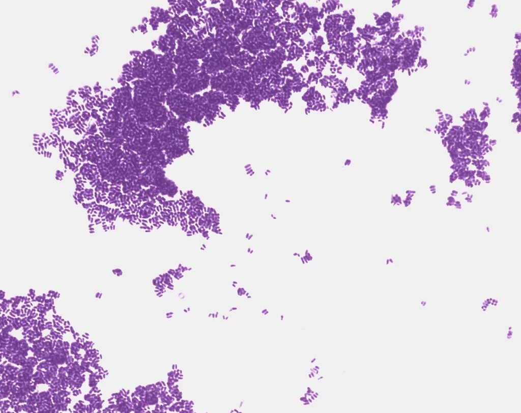 Mobiluncus spp corynebacterium в мазке. Corynebacterium glutamicum микроскоп. бактерий corynebacterium glutamicum.. brevibacterium ammoniagenes. corynebacterium ammoniagenes.