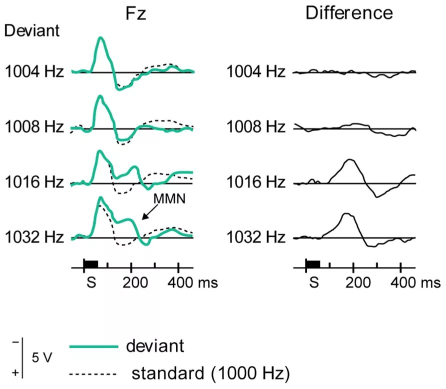 Show difference. Негативность рассогласования. Негативность рассогласования Наатанен. Негативность рассогласования n400. Event related potentials.