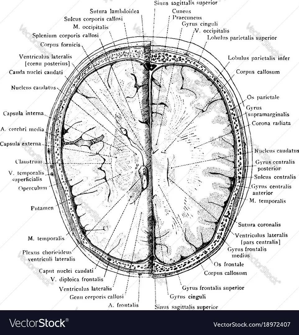 Sulcus sinus латынь. Sulcus sagittalis superior. splenium corporis callosi анатомия. pars centralis ventriculi lateralis анатомия. sinus sagittalis superior.