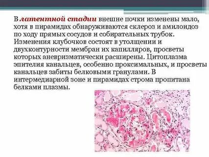 Амилоидоз почки описание