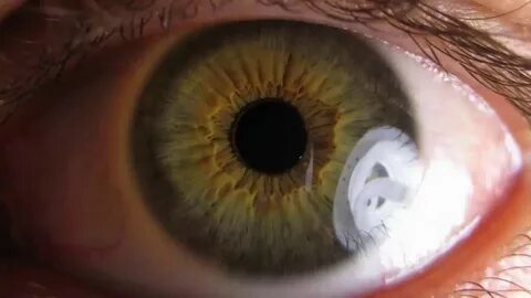 Eye hole