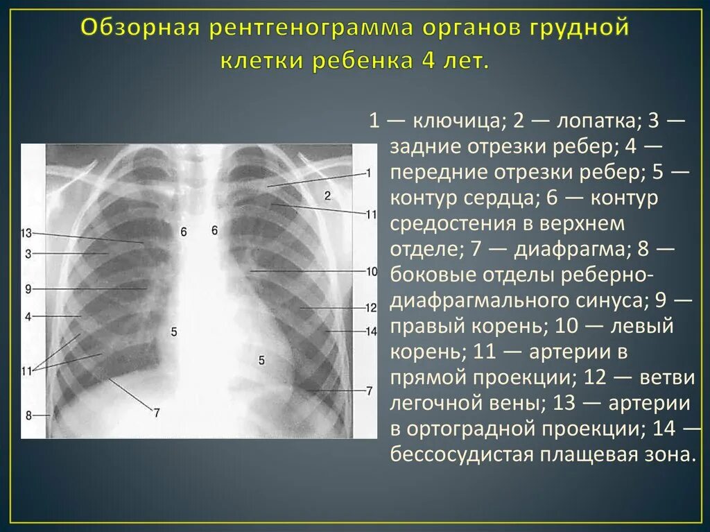 Грудная клетка ребенка 2 года. Рентген грудной клетки боковая проекция. Рентген грудной клетки в боковой проекции норма. Обзорная рентгенограмма органов грудной клетки. Обзорная рентгенограмма грудной клетки.