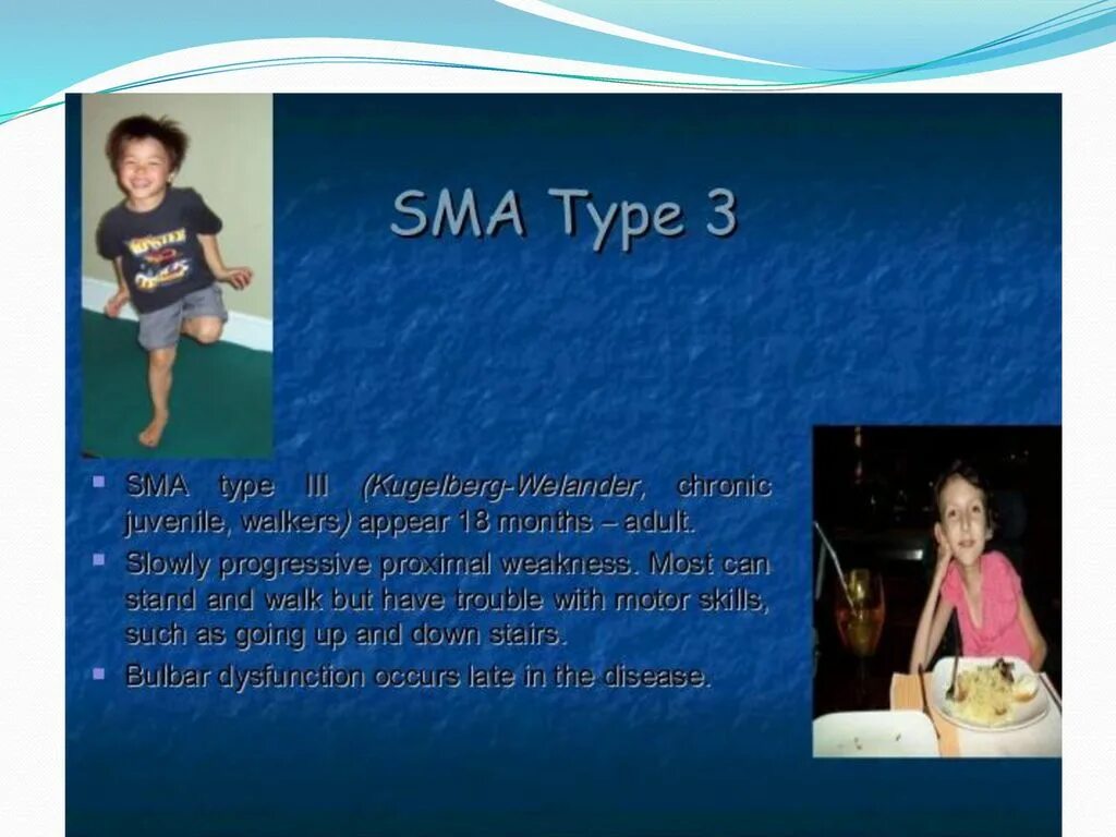 Спинальная мышечная атрофия симптомы. Спинальная мышечная атрофия патогенез. Сма 3 типа это. Спинальная мышечная атрофия 3 типа. Спинальная мышечная атрофия кугельберга-веландера.