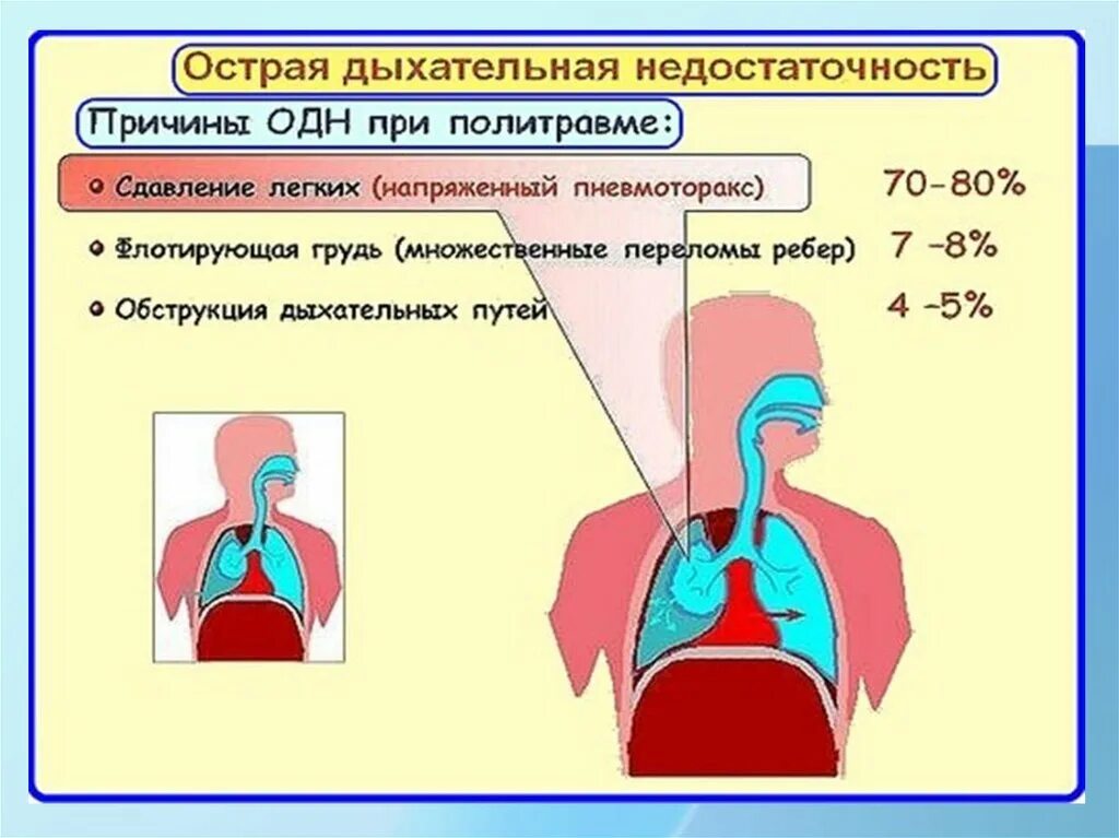 Острая дыхательная недостаточность. Острая дыхательная недостаточность причины. Дыхательная недостаточность у детей. Синдром острой дыхательной недостаточности у детей. Признаки недостаточности легких