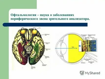 Дети с нарушениями зрительного анализатора