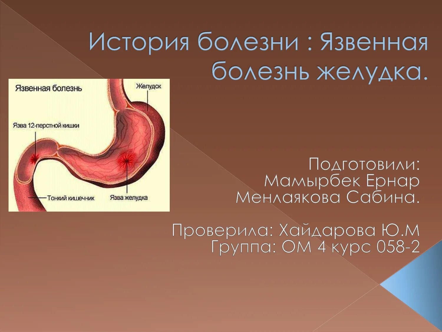 Хирургические заболевания желудка. Язва желудка и 12 перстной кишки. Язвенная болезнь 12-ти перстной кишки (ДПК). Язва 12 перстной кишки слайды. Язвенная болезнь желудка и двенадцатиперстной кишки презентация.