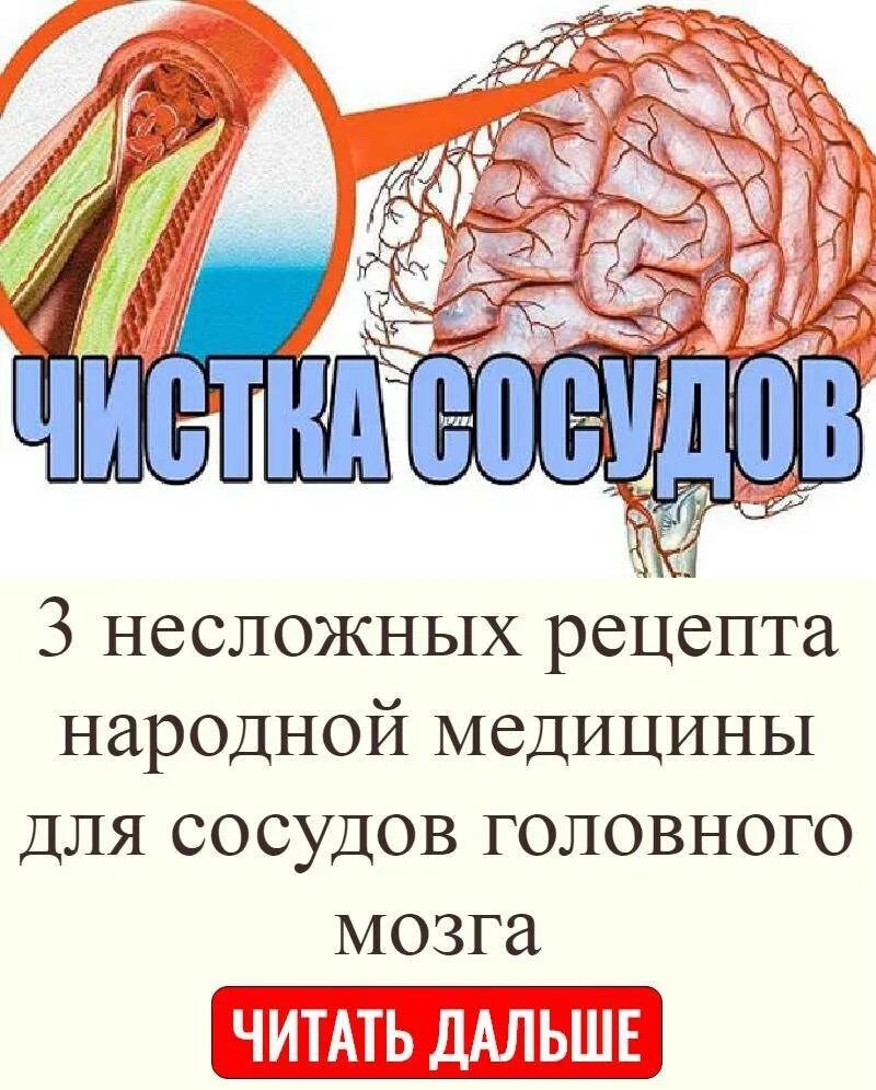 Очищение сосудов головного мозга. Препараты для очистки сосудов и капилляров головного мозга. Средство для очищения сосудов головного мозга.