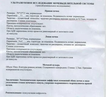 Узи объема остаточной мочи