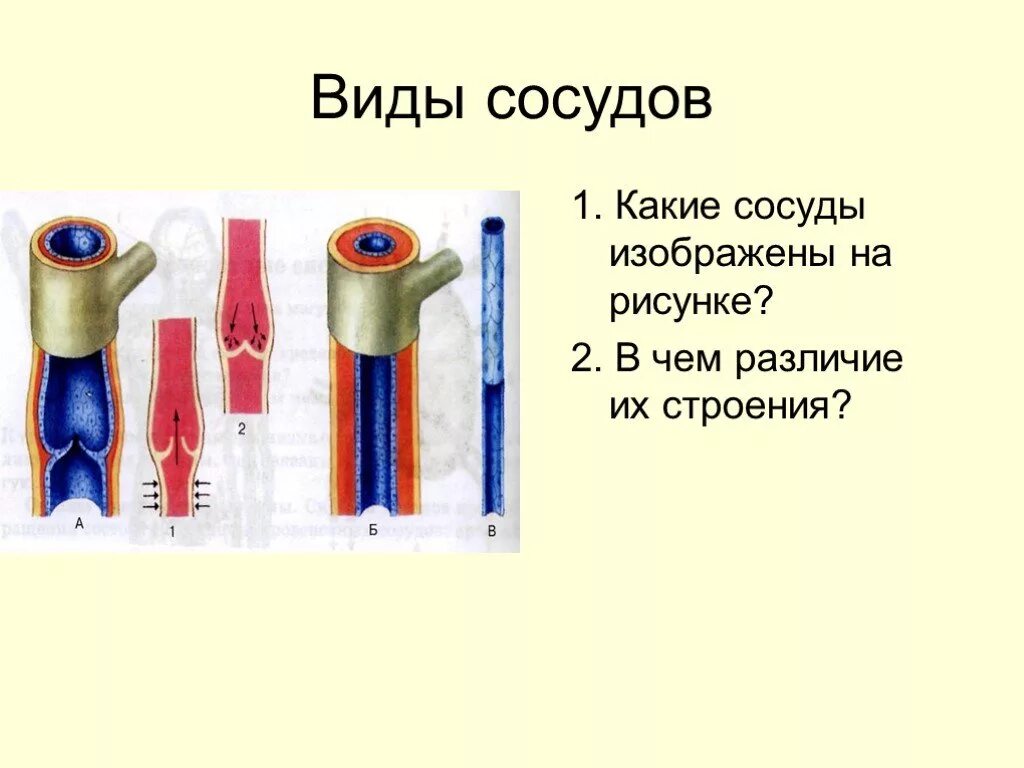 Какой сосуд называется. Виды сосудов. Виды артерий. Какой сосуд изображён на рисунке. Сосуды различия рисунок.