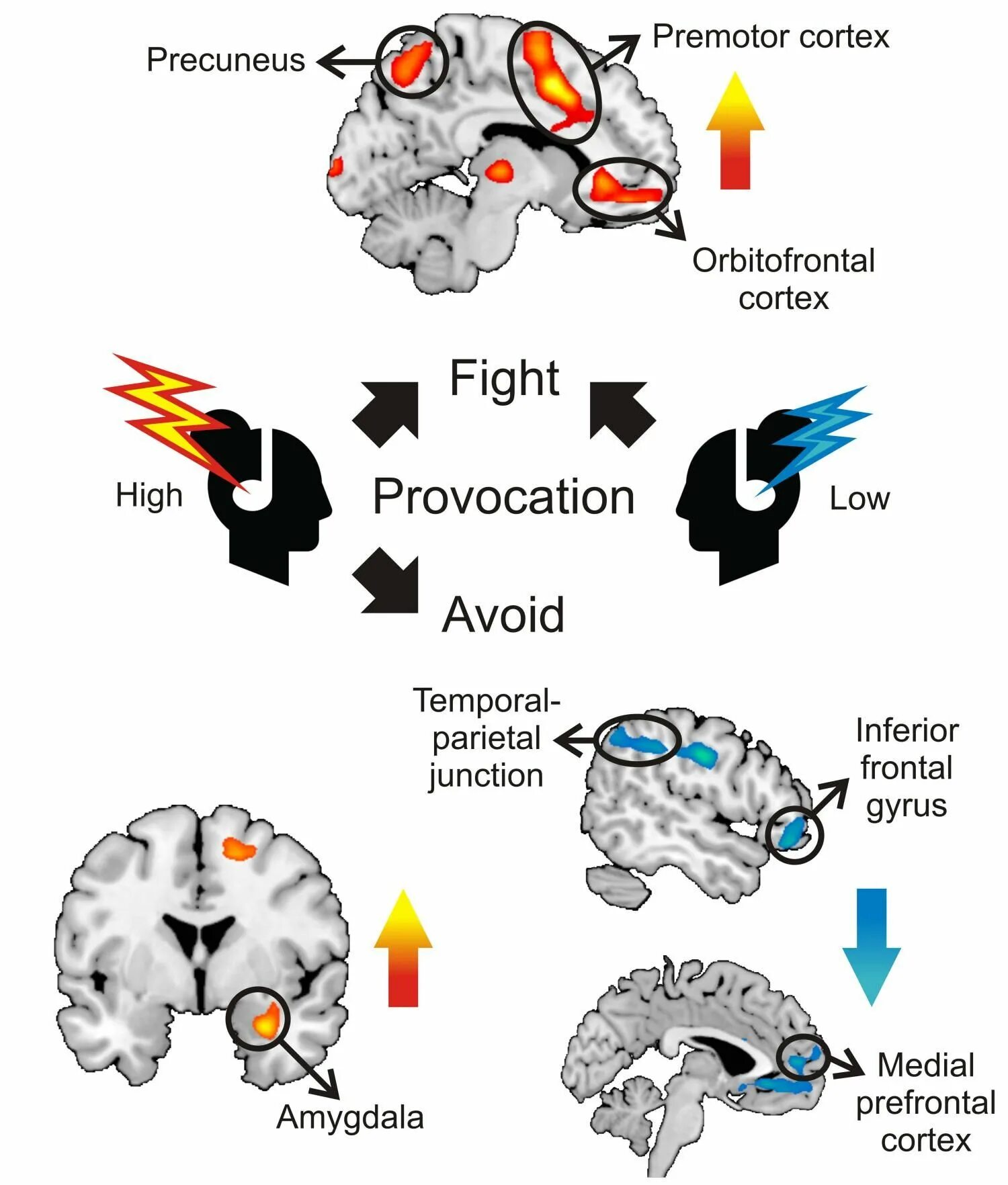 Flight response. Fight of flight. прекунеус. fight or flight. to fight in the brain.